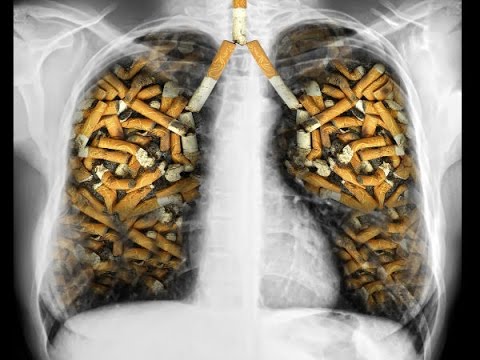 How smoking affects the lungs
